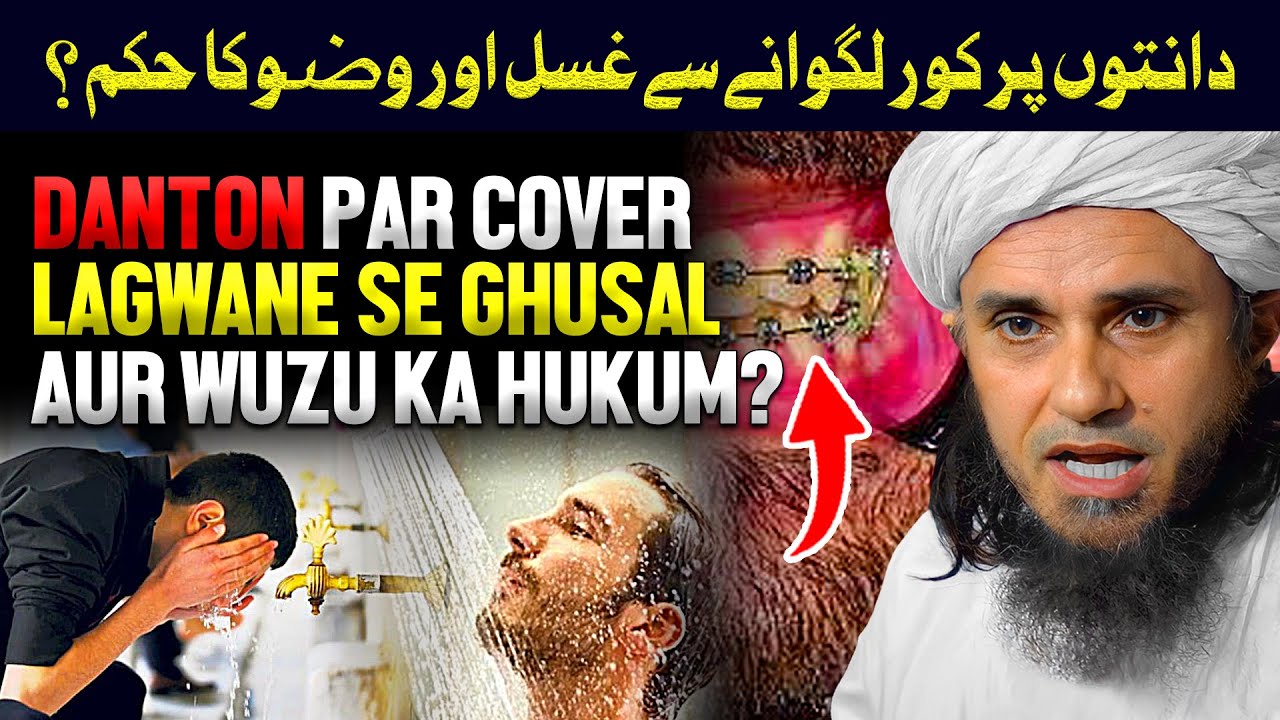 Danton Par Cover Lagwaney Sey Wuzu Aor Ghusal Ka Hukum? | Ask Mufti Tariq Masood